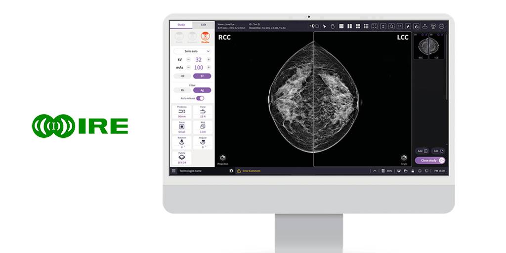 Sistema de Mamografía Digital de Campo Completo