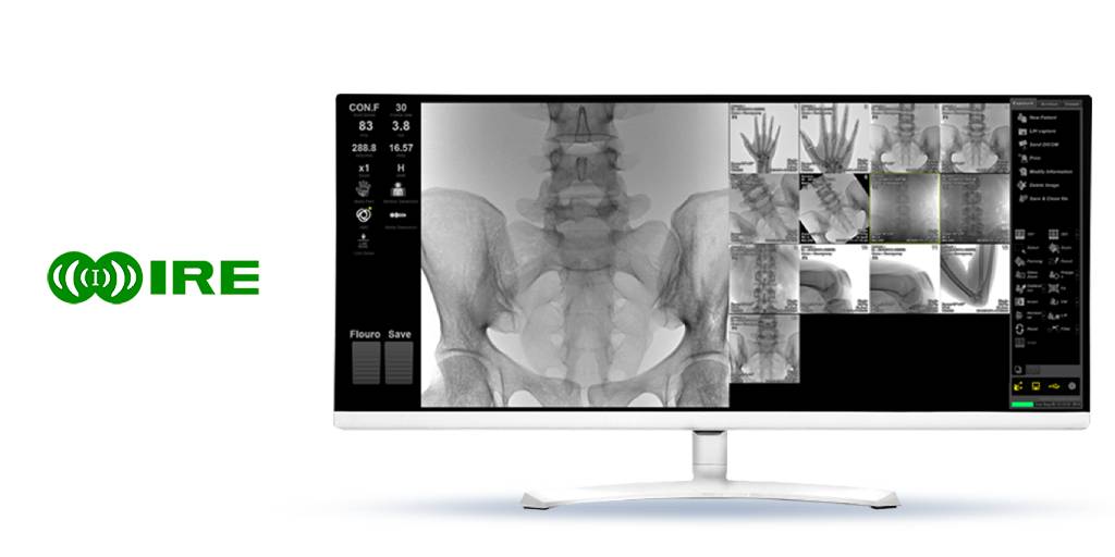Ventajas de los equipos de radiocirugía con flat panel