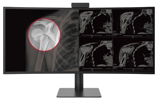 Monitor de diagnóstico médico curvo de 40 pulgadas LG