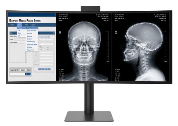 IRE Rayos X presenta el Monitor de diagnóstico médico curvo de 40 pulgadas LG