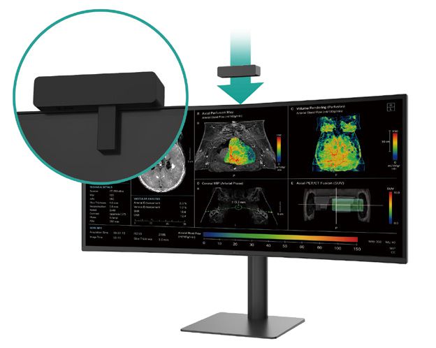Monitor de diagnóstico médico curvo de 40 pulgadas LG IRE Rayos X