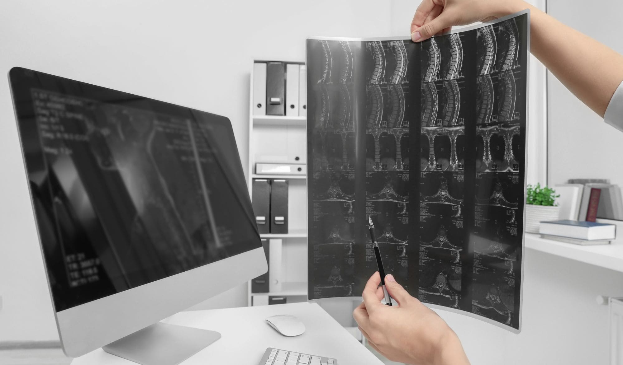 Equipos de resonancia magnética abiertos y cerrados