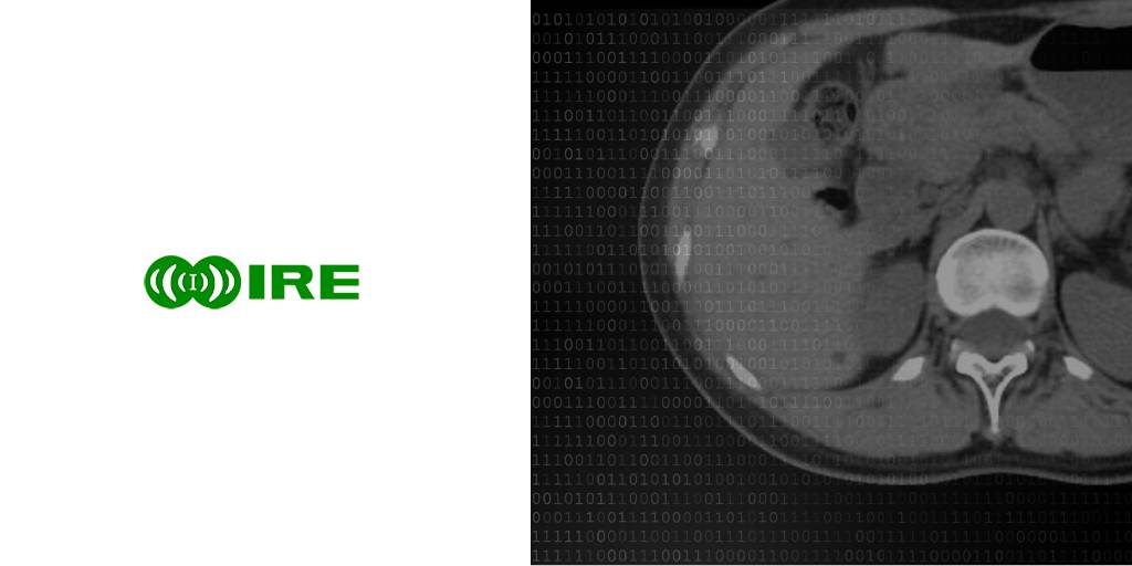 Qué es la Tecnología Clarity