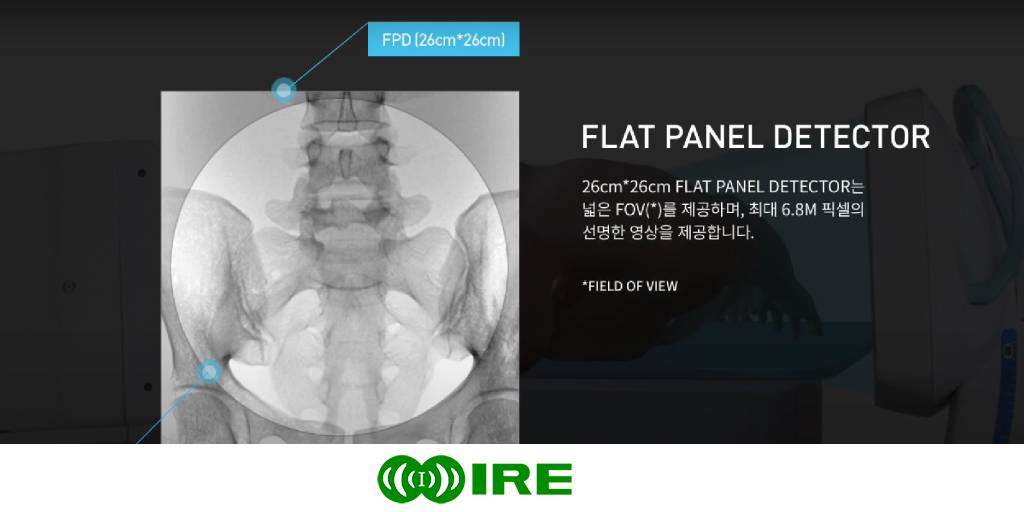 Ventajas de los equipos de radiocirugía con flat panel