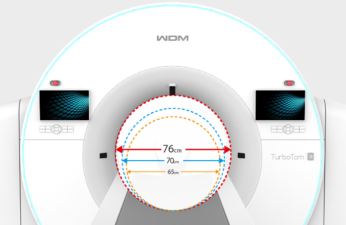 Tamaño del Gantry TAC